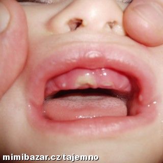 Prořezávají se Vašim dětem zoubky s těžkostí?